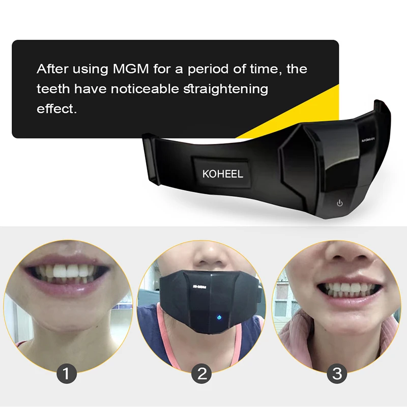 Teeth Straightener with Harmonic Vibration, Orthodontics Retainer and Teeth Aligner Braces - Image 5